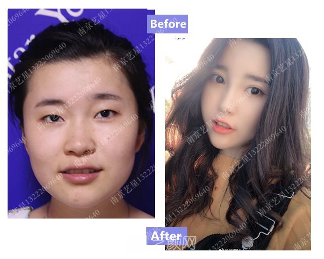 出道三年，她整成這樣終于亮相芒果臺啦！