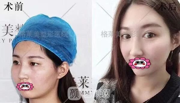 福州格萊美跨年造美節(jié)開始啦，四重好禮送不停，5人同行項(xiàng)目5折起~