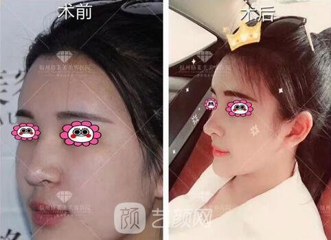 福州格萊美跨年造美節(jié)開始啦，四重好禮送不停，5人同行項(xiàng)目5折起~