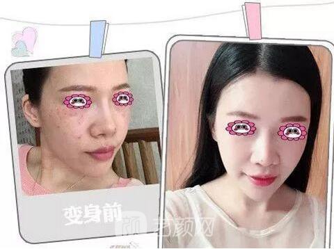 福州格萊美跨年造美節(jié)開始啦，四重好禮送不停，5人同行項(xiàng)目5折起~