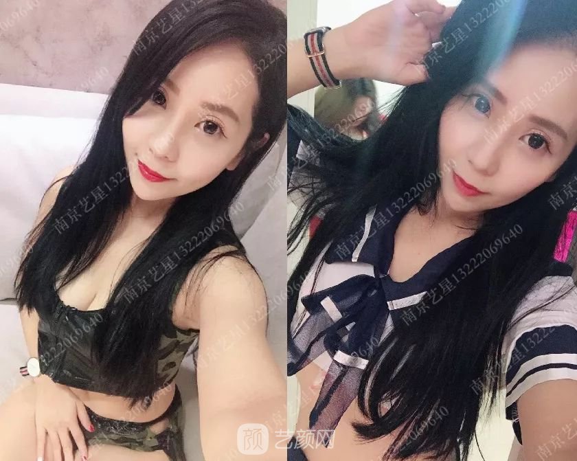 只需要5分鐘，我的鼻子變高了！——南京藝星玻尿酸隆鼻~