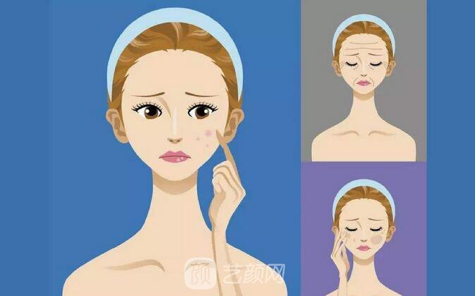 光子嫩膚去痘2019全新價格表