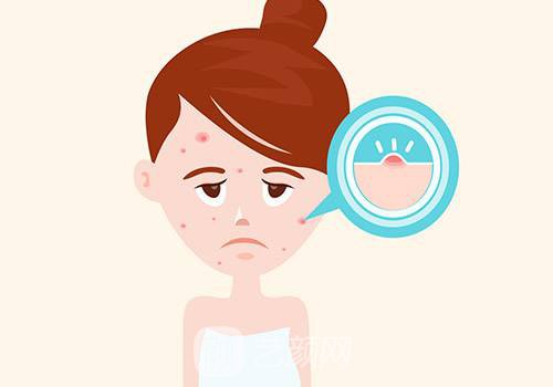 彩光去痘痘要多少錢