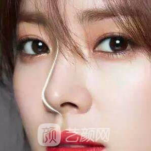 俗話說：三分整形，七分養(yǎng)護(hù)!關(guān)于術(shù)后養(yǎng)護(hù)，你做到幾分