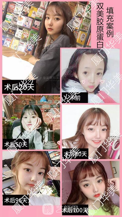 不用工具，10秒自測(cè)肌膚年齡的方法在這，戳我！