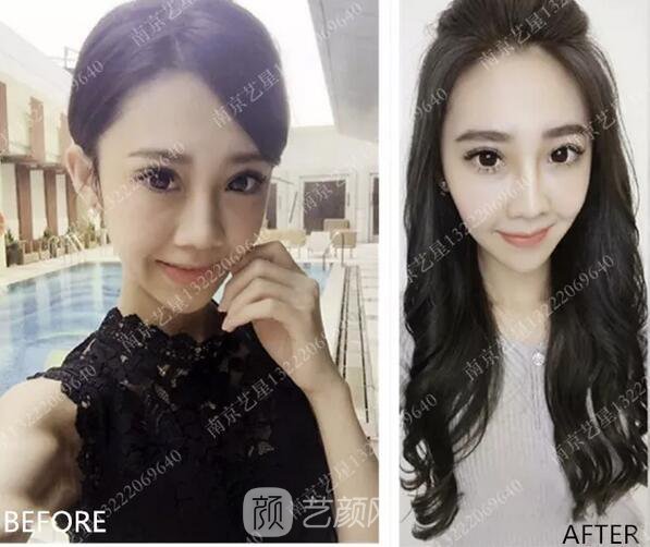 眼霜不管用，拿什么拯救你我的淚溝~