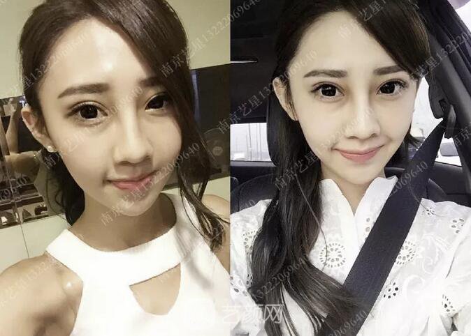 眼霜不管用，拿什么拯救你我的淚溝~