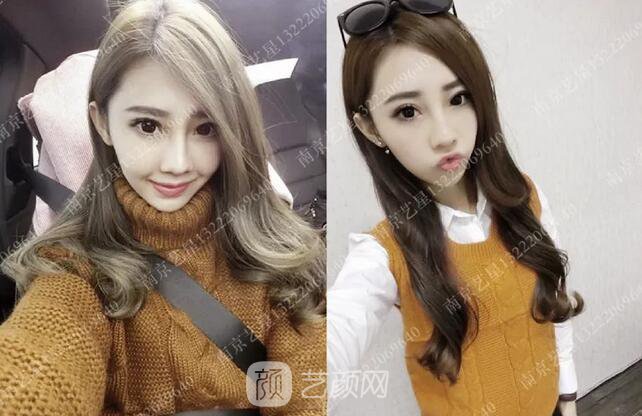 眼霜不管用，拿什么拯救你我的淚溝~