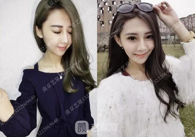 眼霜不管用，拿什么拯救你我的淚溝~