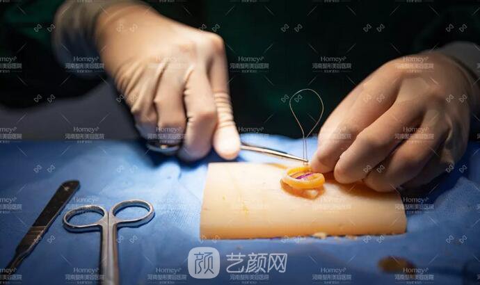 【取肋軟骨會影響孩子胸廓發(fā)育嗎？】