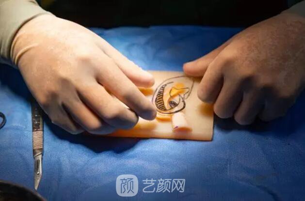 【再造的耳朵軟硬度摸起來和正常耳朵一樣嗎？】