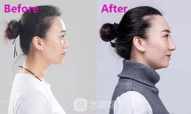 曾經(jīng)被我嘲笑的小眼睛室友，如今變得艷壓群芳？！