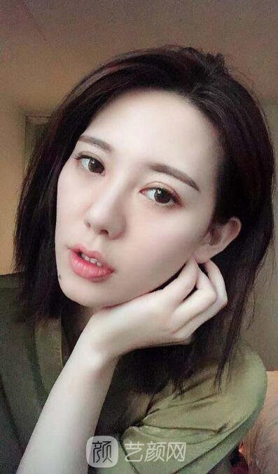 講個(gè)超棒超美的案例