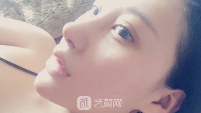 長沙湘雅墊下巴價(jià)格多少?