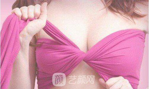 假體隆胸失敗后修復(fù)要多少錢?