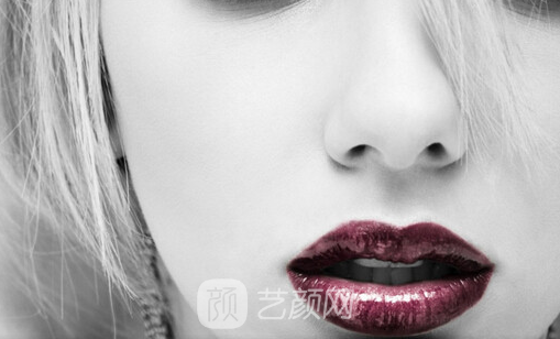 深圳恩吉娜做了下巴和鼻子，鼻型挺起來了