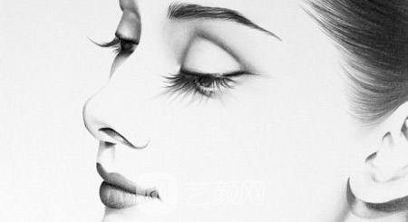 北京愛悅麗整形隆鼻術(shù)后果及保養(yǎng)事項