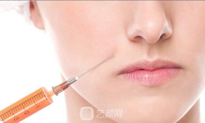 上海南山醫(yī)院塑形專家季錦付:關于吸脂瘦臉的注意事項