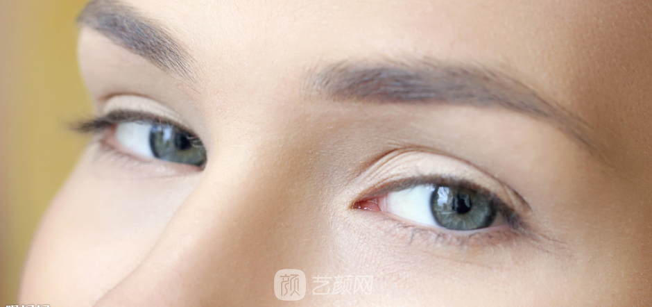 雙眼皮要怎么割，才能別人才看不出來