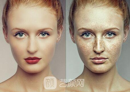 調(diào)節(jié)黃褐斑是長期的工程，需要堅(jiān)持才能見果