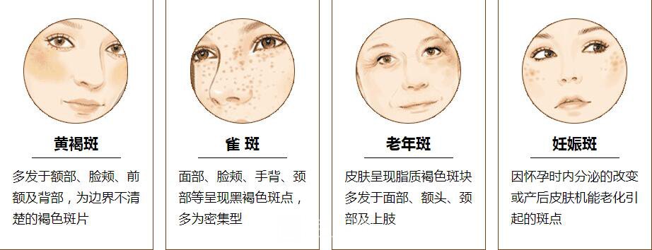 調(diào)節(jié)黃褐斑是長期的工程，需要堅(jiān)持才能見果