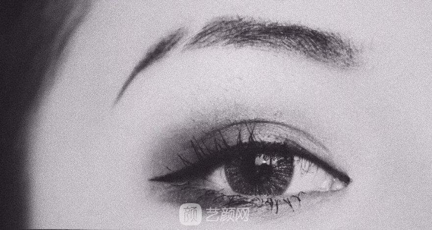 全飛秒手術與其它近視激光手術區(qū)別在哪些地方