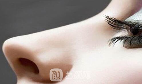 柳葉硅膠墊鼻梁多少錢(qián)?