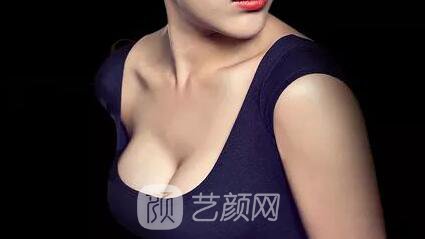 娜高乳房假體隆胸一個月后 挺胸走路找回了自信
