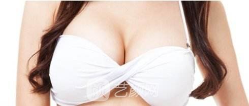 娜高乳房假體隆胸一個月后 挺胸走路找回了自信