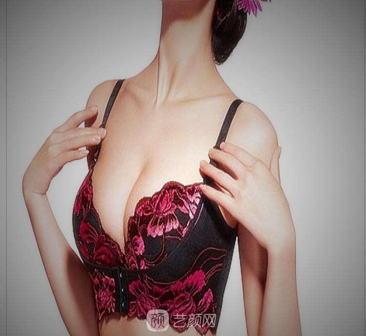 英國娜高假體麗都價格是多少