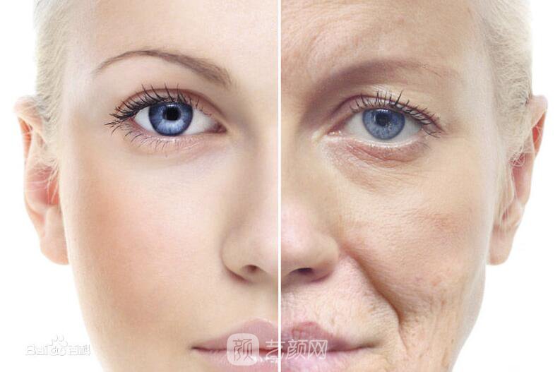 自體脂肪填充童顏術(shù)，讓我也逆生長(zhǎng)了一回