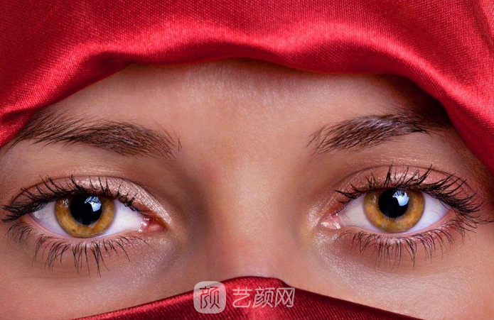 雙眼皮案例：從窄雙眼皮到寬雙眼皮——美，沒有界限。