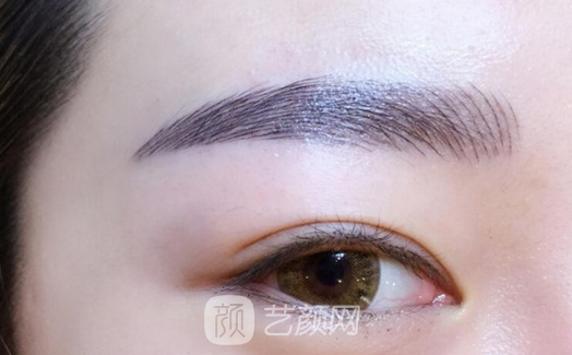 張掖顏藝美整形埋線雙眼皮怎么樣?
