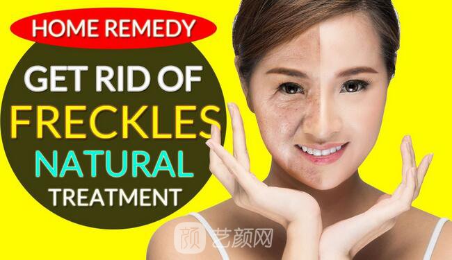 湖南激光祛斑好嗎？