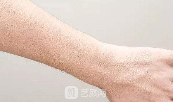 蘭州醫(yī)院激光脫毛多少錢