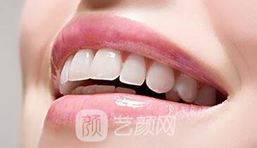 連云港牙齒整形選哪家醫(yī)院?我們一起來(lái)分析一下