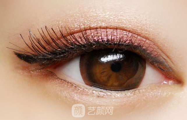 遼陽做雙眼皮去哪家醫(yī)院做果好