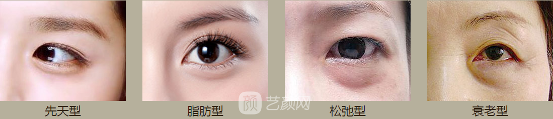 洛陽做眼袋哪里好，費用如何