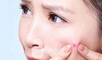 丹東哪去痘比較好?當(dāng)?shù)厍竺勒邅砀嬖V你