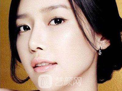 開眼角專家解答開眼角有哪些好處