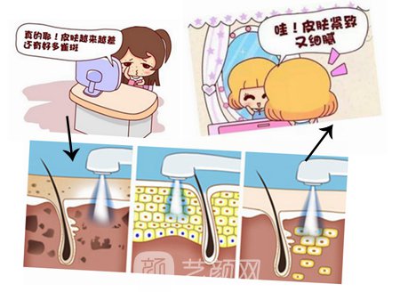 昆明彩光嫩膚多少錢?專業(yè)醫(yī)生為你解答