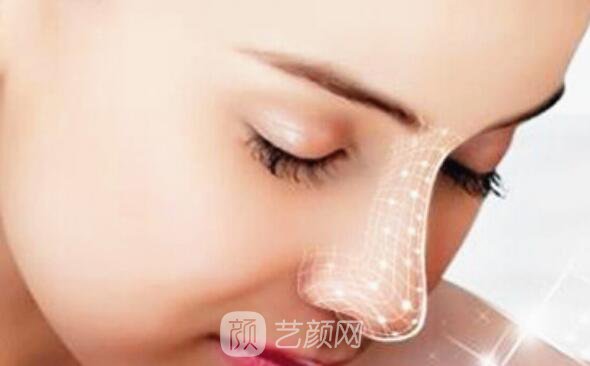 綿陽微晶石隆鼻多少錢