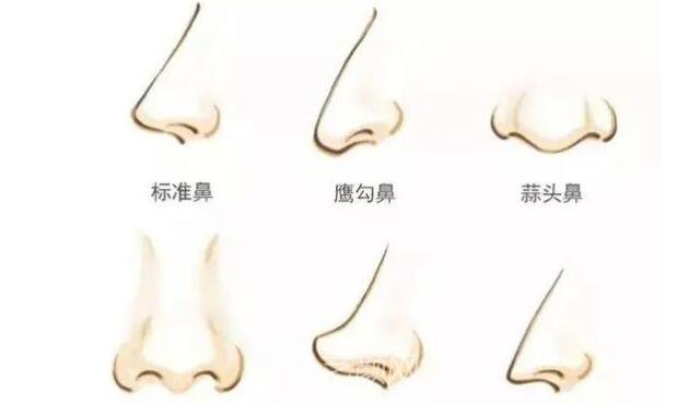 如果你是這幾種鼻形，就要矯正啦!