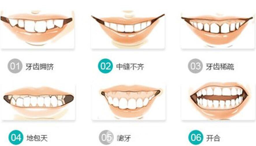 如何阻止地包天的發(fā)生，專業(yè)醫(yī)生為你解答