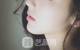 隆鼻案例:隆鼻+雙眼皮+下巴已經(jīng)不是原來自卑的我了~