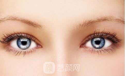 上海優(yōu)利沃斯雙眼皮改變人生走向尖峰