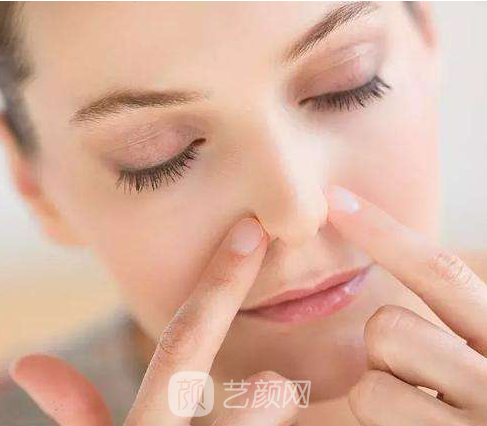 假體隆鼻后，同事都說我像混血兒