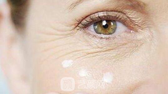 面部去皺術有很多，選適合自己的才是王道