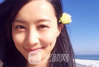 上海百達麗豐蘋果肌多少錢呢？