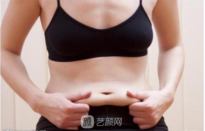 新媽媽分享吸脂經(jīng)歷!朋友都說(shuō)我沒(méi)生過(guò)娃